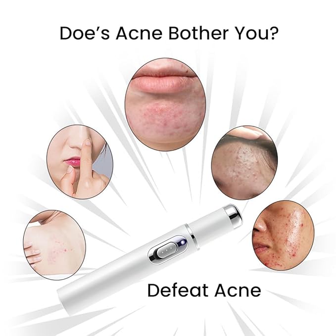 Acne Remover Blue Light Laser Pen
